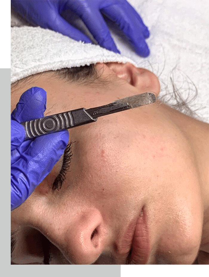 Dermaplane Facial image