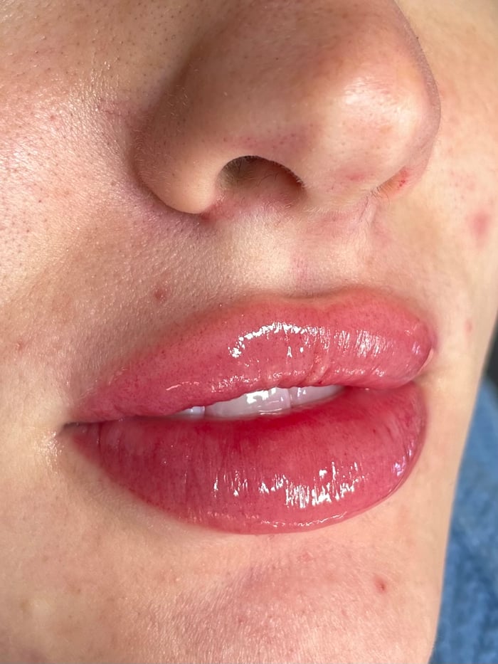 Lip Blushing image